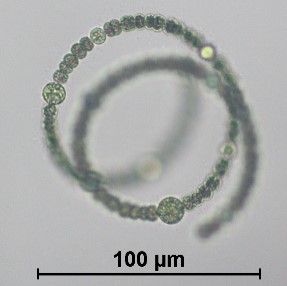 京都市の水道水「カビ臭く」基準値超え　原因は「連日の猛暑で琵琶湖の植物プランクトン増加」煮沸して軽減