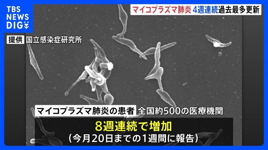 【感染症】「マイコプラズマ肺炎」全国の患者数が4週連続で過去最多更新　手足口病も「警報レベル」超